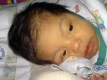 La pequeña Javiera está grave pero estable La pequeña Javiera está grave pero estable