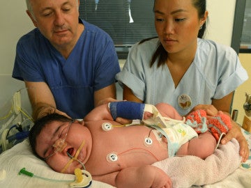 Fotografía de la niña recién nacida con más de 6 kilos de peso