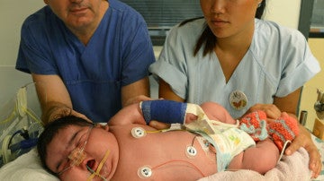 Fotografía de la niña recién nacida con más de 6 kilos de peso