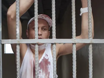 Un pandillero de la Mara 18 se encuentra herido en una celda en el Hospital Escuela en Tegucigalpa Un pandillero de la Mara 18 se encuentra herido en una celda en el Hospital Escuela en Tegucigalpa