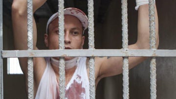 Un pandillero de la Mara 18 se encuentra herido en una celda en el Hospital Escuela en Tegucigalpa