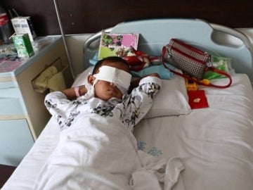 El niño al que le extirparon los ojos en china, en recuperación El niño al que le extirparon los ojos en china, en recuperación