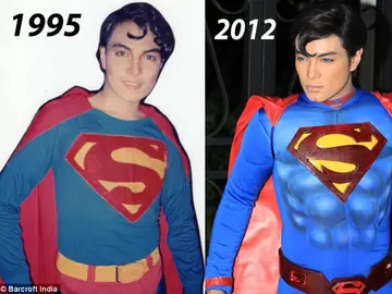 Imagen de los cambios tras las 19 operaciones de estética Imagen de los cambios tras las 19 operaciones de estética