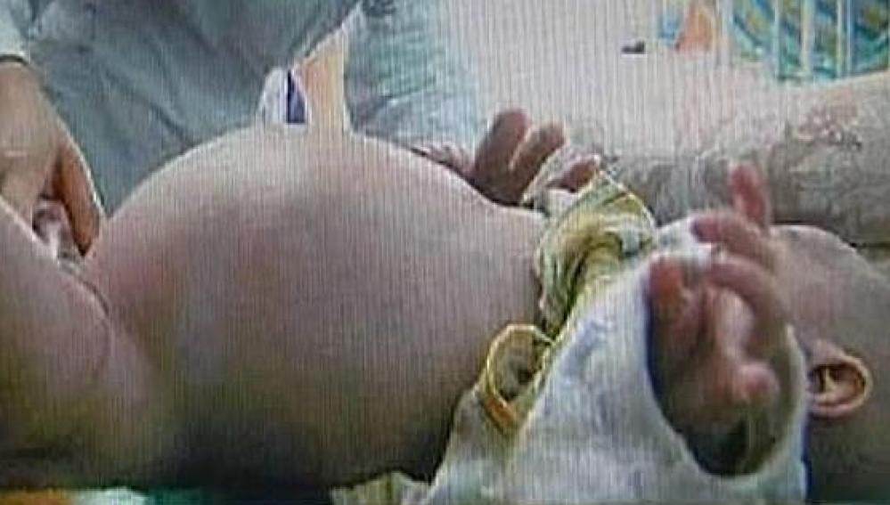 Imagen del niño chino de dos años 'embarazado'