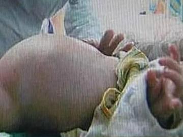 Imagen del niño chino de dos años 'embarazado' Imagen del niño chino de dos años 'embarazado'