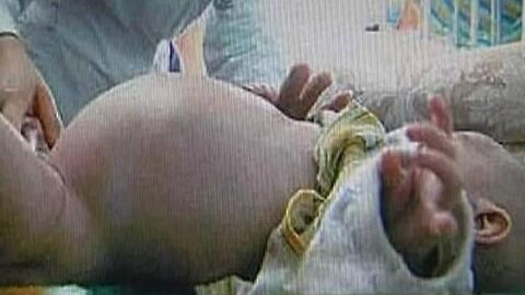 Imagen del ni&ntilde;o chino de dos a&ntilde;os 'embarazado'