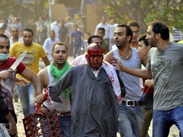 Un manifestante herido en Egipto