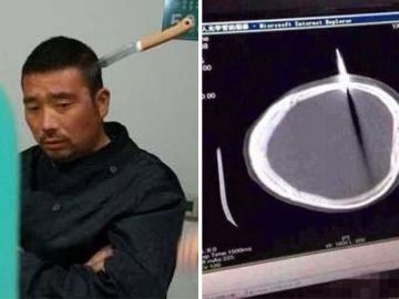Ho Lung espera con el cuchillo en la cabeza Ho Lung espera con el cuchillo en la cabeza