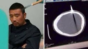 Ho Lung espera con el cuchillo en la cabeza
