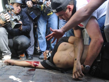 Un herido en las protestas en Venezuela