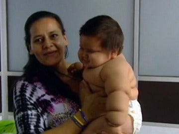 Un bebé obeso con sólo ocho meses