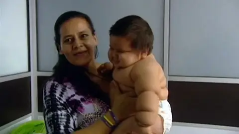Un bebé obeso con sólo ocho meses Un bebé obeso con sólo ocho meses
