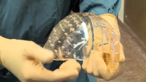 Cráneo de plástico hecho con una impresora 3D Cráneo de plástico hecho con una impresora 3D