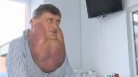 00042