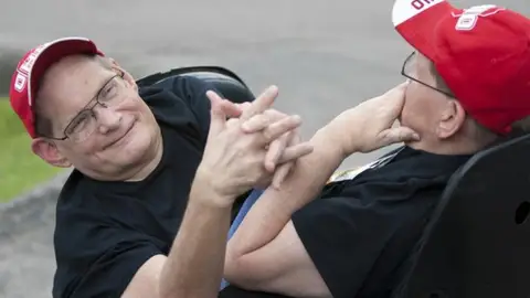 Donnie y Ronnie, los gemelos siameses más longevos del mundo Donnie y Ronnie, los gemelos siameses más longevos del mundo