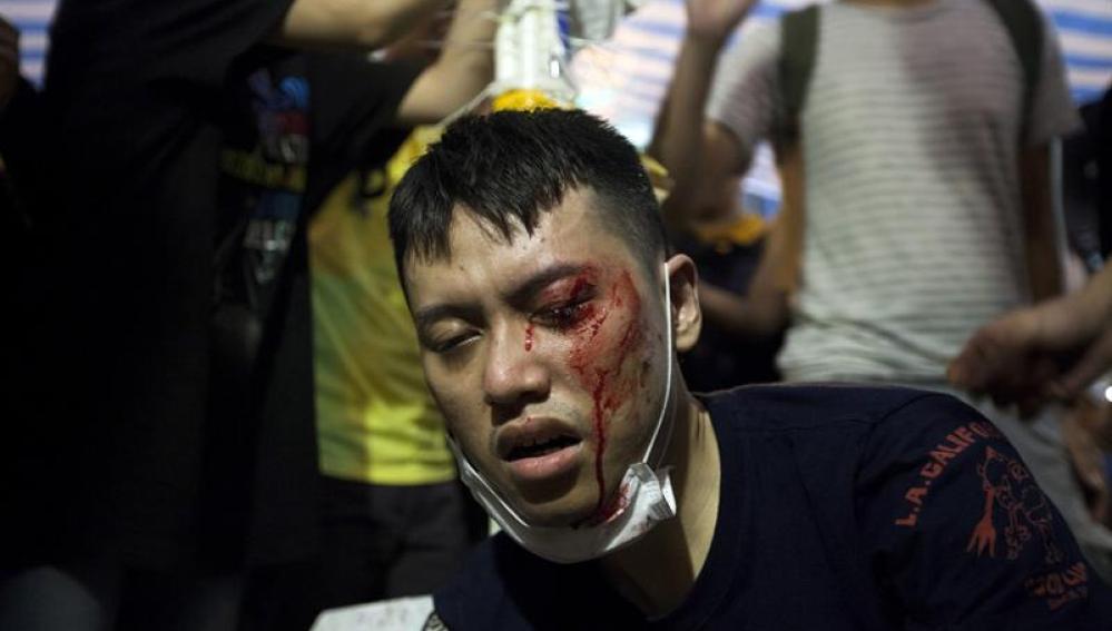 Un manifestante, herido por los ataques en Hong Kong