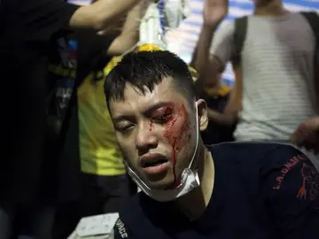 Un manifestante, herido por los ataques en Hong Kong Un manifestante, herido por los ataques en Hong Kong