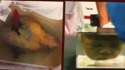 Encuentran restos humanos en varias cajas Encuentran restos humanos en varias cajas