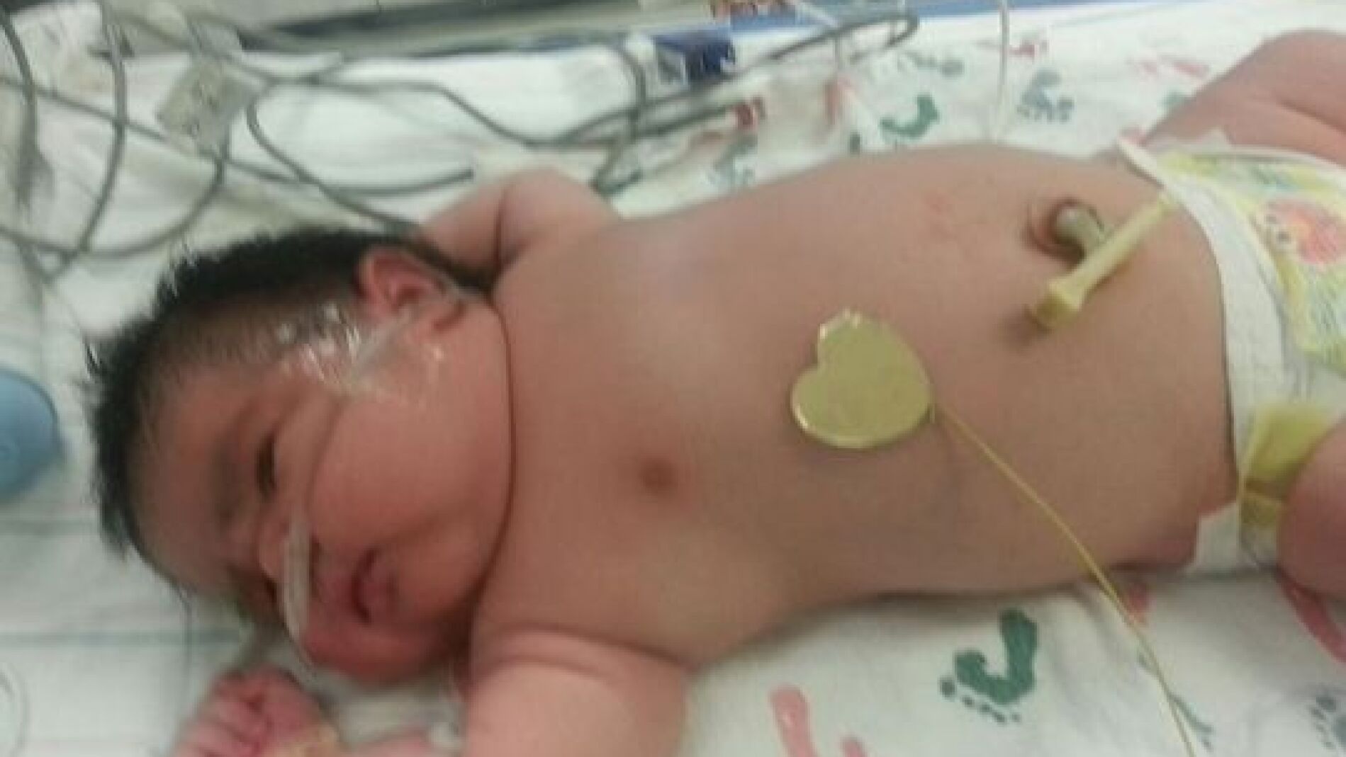 El beb&eacute; permanece ingresado en el hospital de Colorado.