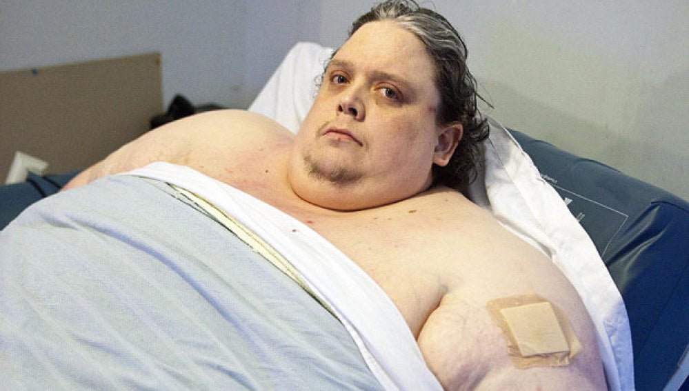 Muere el hombre más gordo del mundo, llegó a pesar 444 kilos