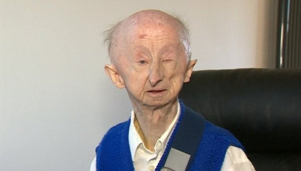 Alan Barnes, es pensionista y sufre una discapacidad