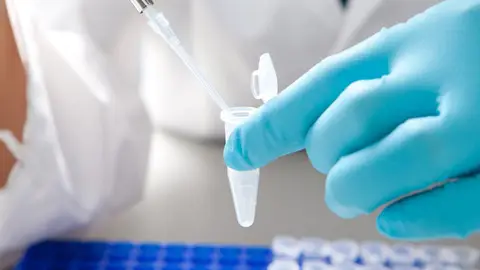 La biopsia líquida una nueva técnica para analizar la evolución del cáncer La biopsia líquida una nueva técnica para analizar la evolución del cáncer