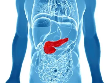 Gráfico de cáncer de páncreas Gráfico de cáncer de páncreas