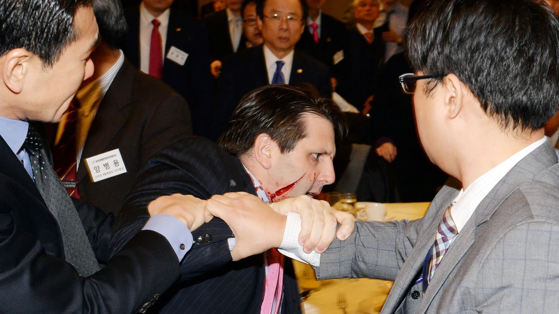 El embajador de Estados Unidos en Corea del Sur, Mark Lippert El embajador de Estados Unidos en Corea del Sur, Mark Lippert