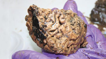 El cerebro más antiguo del mundo