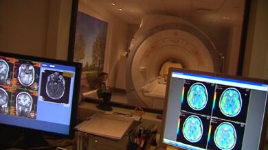 Un laboratorio de Granada descubre un nuevo método para detectar el alzheimer