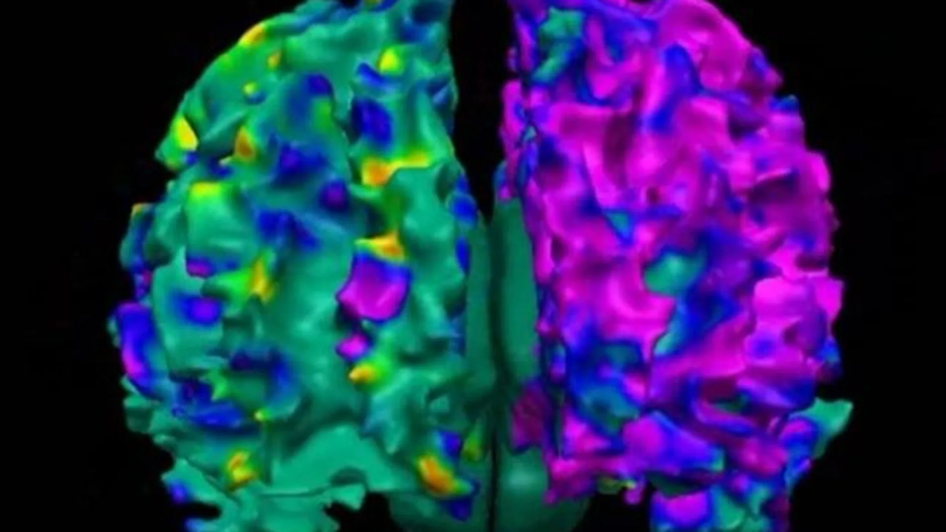 Proteína clave en las enfermedades neurodegenerativas Proteína clave en las enfermedades neurodegenerativas