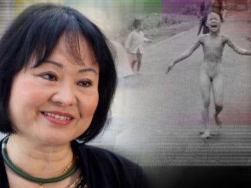  Kim Phuc