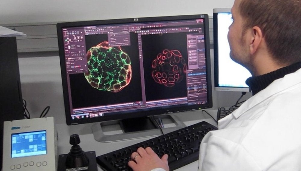 Una huella de la metástasis puede identificar el origen del cáncer