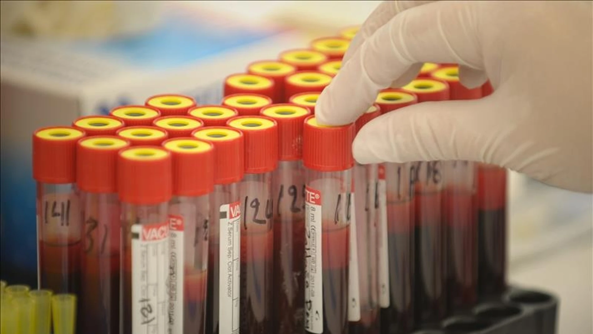 Muestras de sangre Muestras de sangre