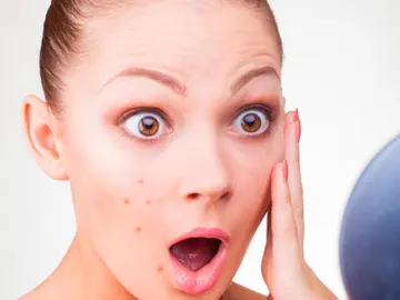 Chica con granos Chica con granos