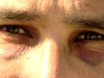 00796