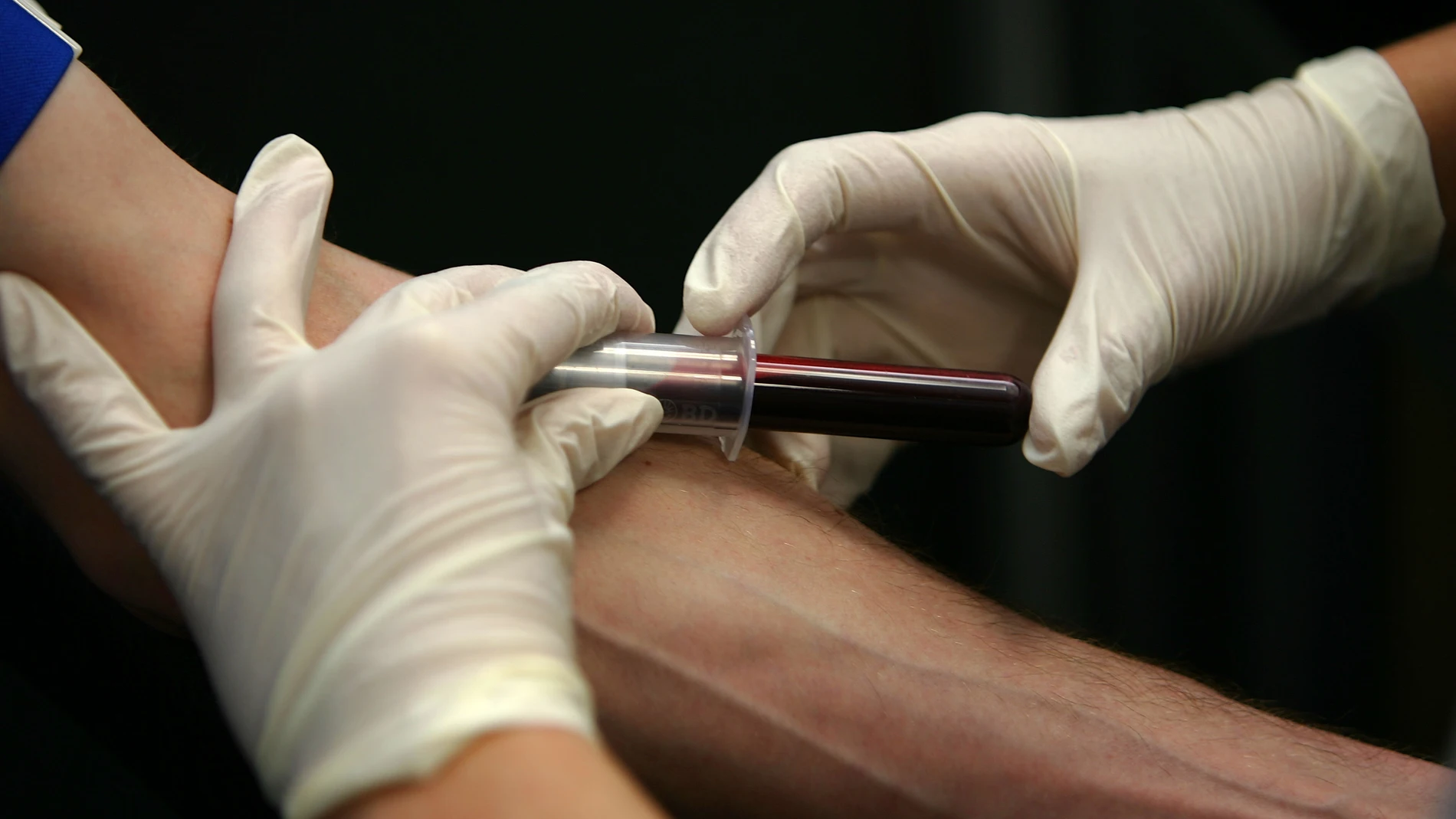 Desarrollan en Estados Unidos el primer dispositivo de extracción de sangre sin agujas Desarrollan en Estados Unidos el primer dispositivo de extracción de sangre sin agujas