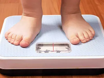 Sobrepeso en niños Sobrepeso en niños