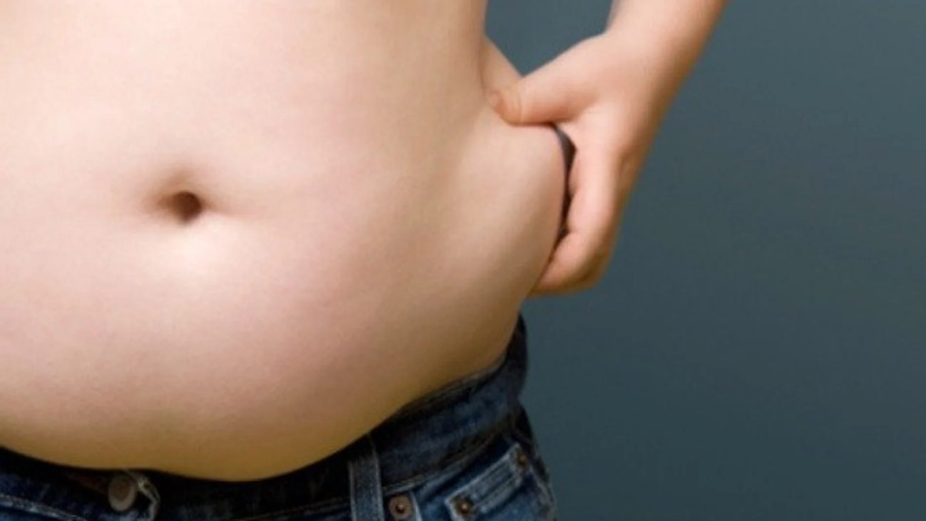Acumulación de grasa abdominal Acumulación de grasa abdominal