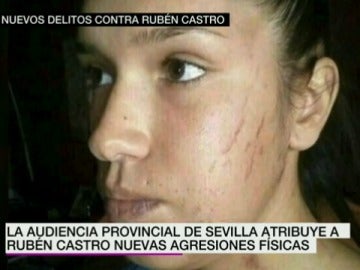 Rubén Castro, acusado de nuevos delitos