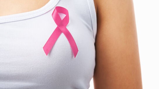 Google desarrolla un sistema que detecta el c&aacute;ncer de mam&aacute; m&aacute;s eficazmente que los redi&oacute;logos