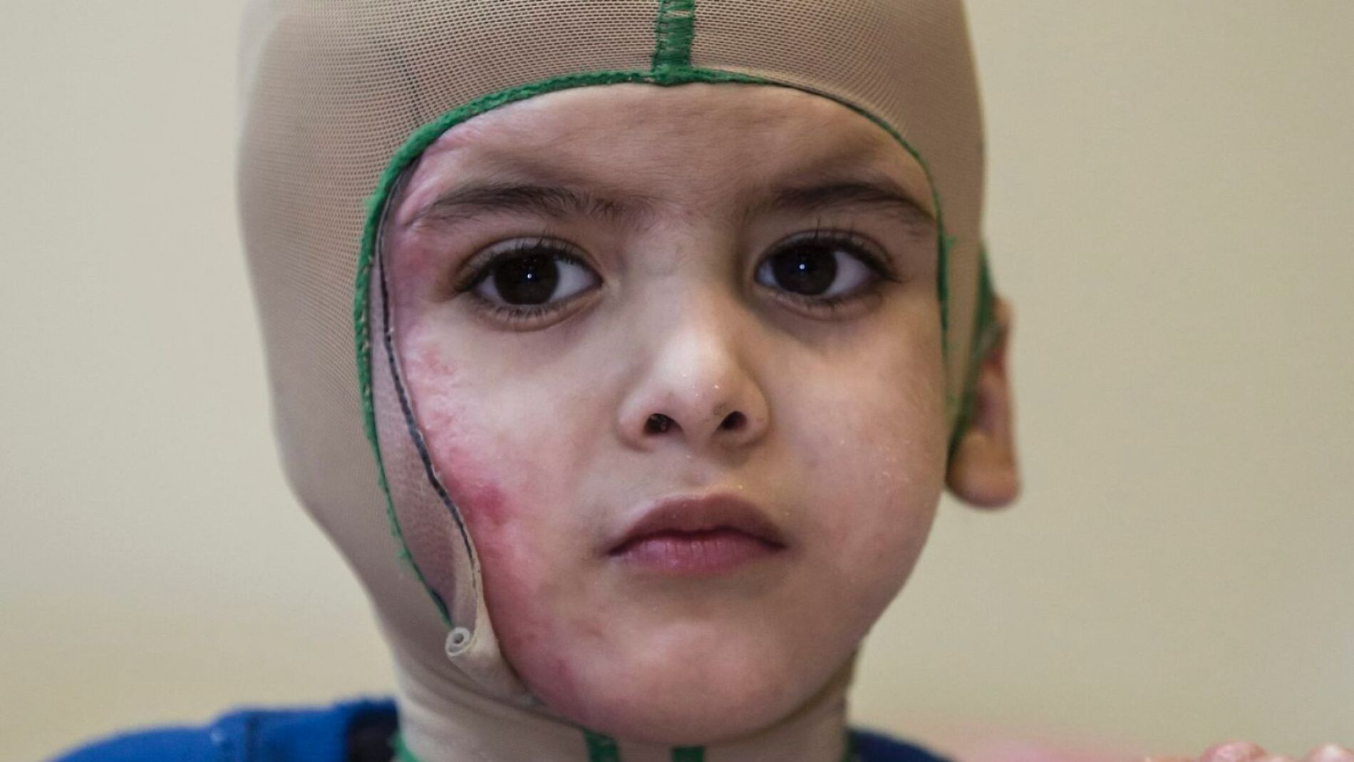  Ahmad Dawabshe, el ni&ntilde;o palestino que sobrevivi&oacute; a un ataque