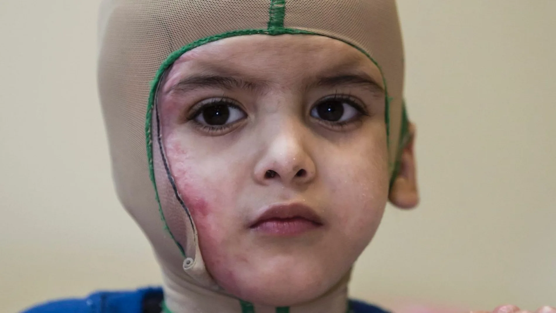 Ahmad Dawabshe, el niño palestino que sobrevivió a un ataque Ahmad Dawabshe, el niño palestino que sobrevivió a un ataque