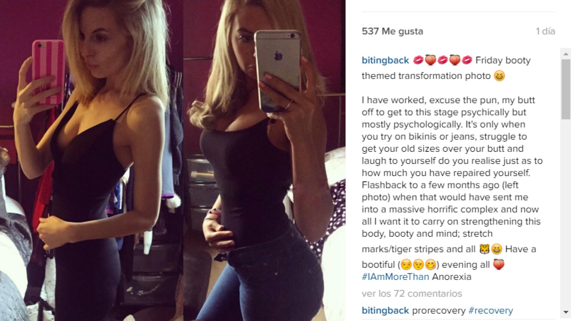 Instant&aacute;nea de su recuperaci&oacute;n en Instagram