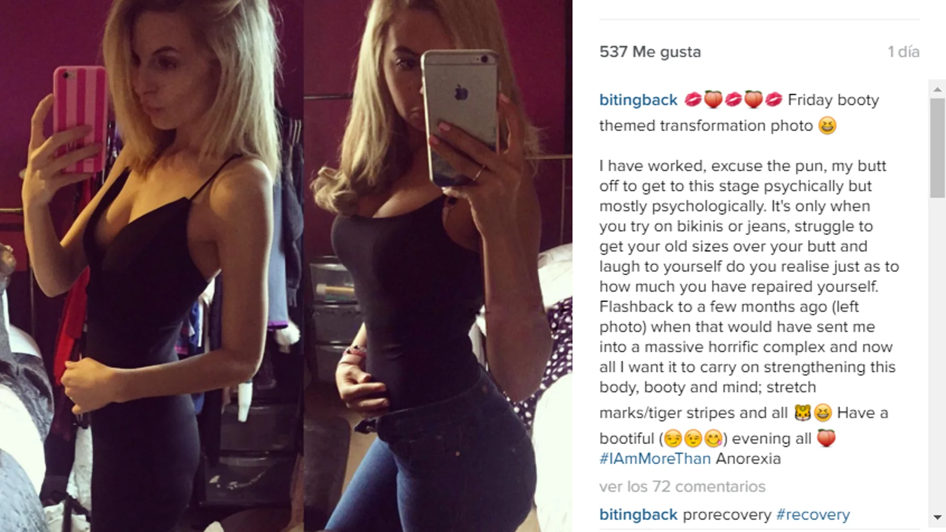 Instantánea de su recuperación en Instagram Instantánea de su recuperación en Instagram