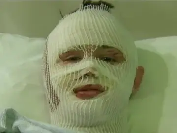Mason Wells, el joven que sobrevivió a los atentados de Brosto, París y Bruselas, en el hospital Mason Wells, el joven que sobrevivió a los atentados de Brosto, París y Bruselas, en el hospital