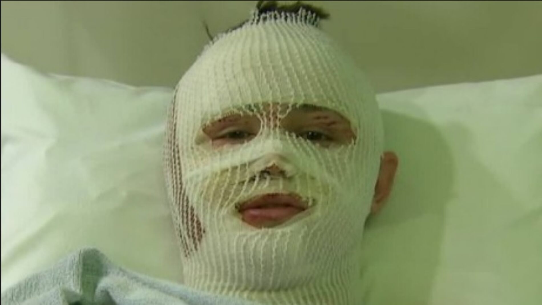 Mason Wells, el joven que sobrevivi&oacute; a los atentados de Brosto, Par&iacute;s y Bruselas, en el hospital