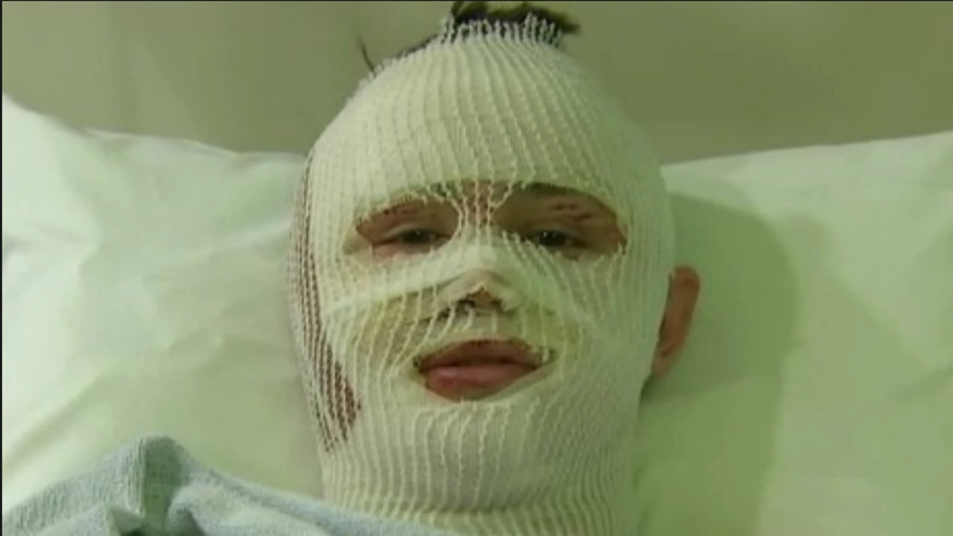 Mason Wells, el joven que sobrevivió a los atentados de Brosto, París y Bruselas, en el hospital Mason Wells, el joven que sobrevivió a los atentados de Brosto, París y Bruselas, en el hospital