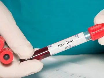 Test de VIH a domicilio Test de VIH a domicilio