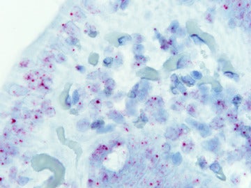 Células intestinales de una persona sana